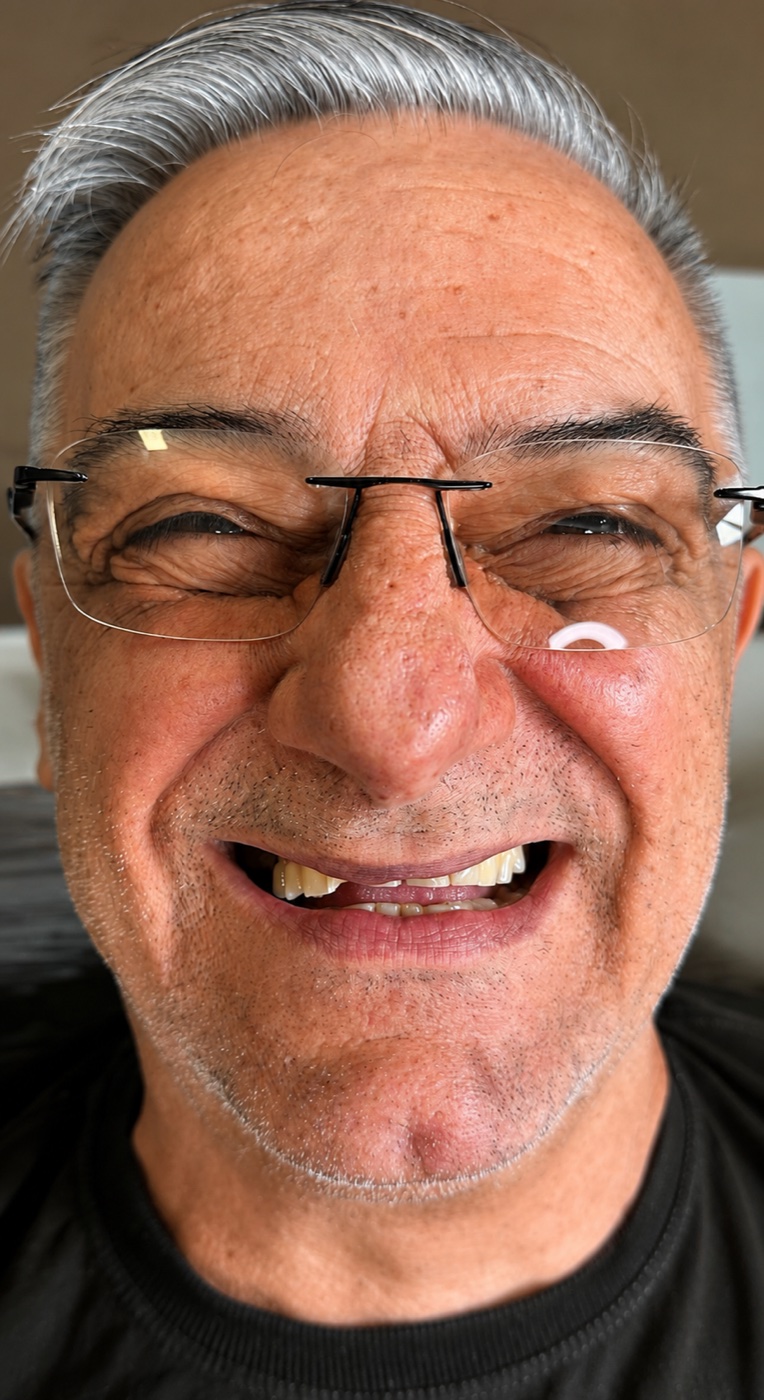 Antes — situação inicial, caso 2